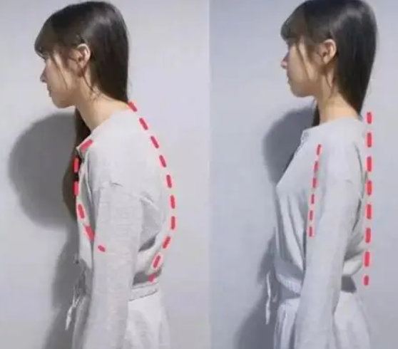 Posture Model From Rear Why is it easy to get tired if you have the wrong posture? Models' body ...